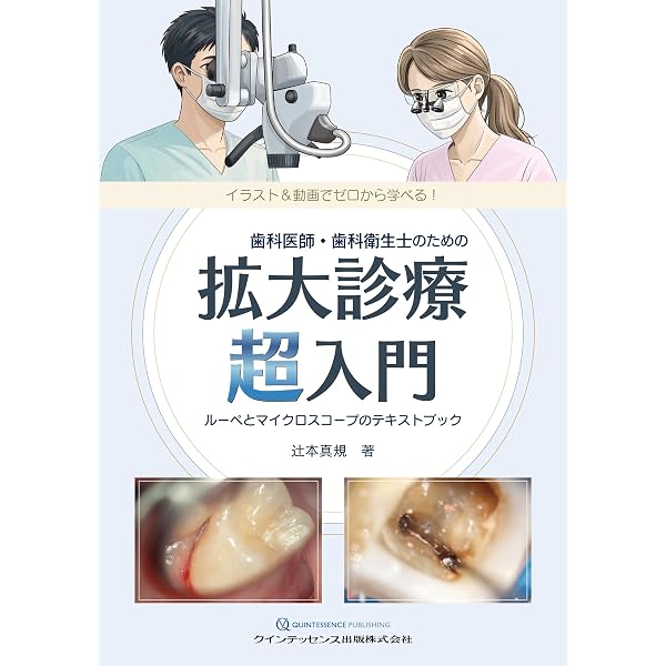Amazon.co.jp: 成功に導く考えかたと着眼点がわかる歯内療法のルール